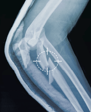 X-Ray Machine in use